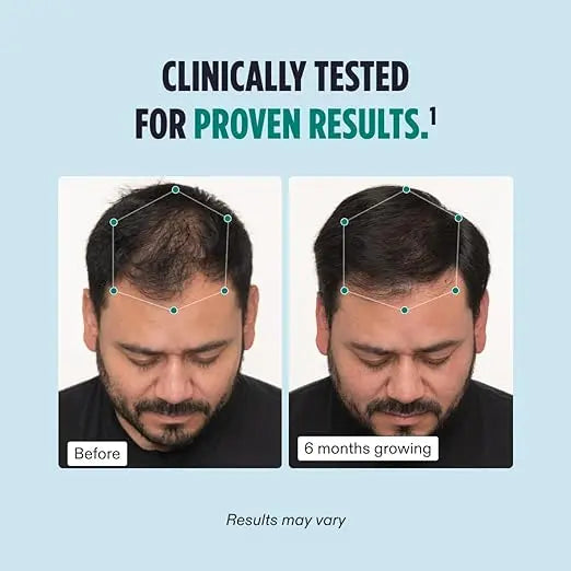 Nutrafol Men's Hair Growth Supplements Pack of 3 , Clinically Tested for Visibly Thicker Hair and Scalp Coverage, Dermatologist Recommended - 1 Month Supply - Beautglo