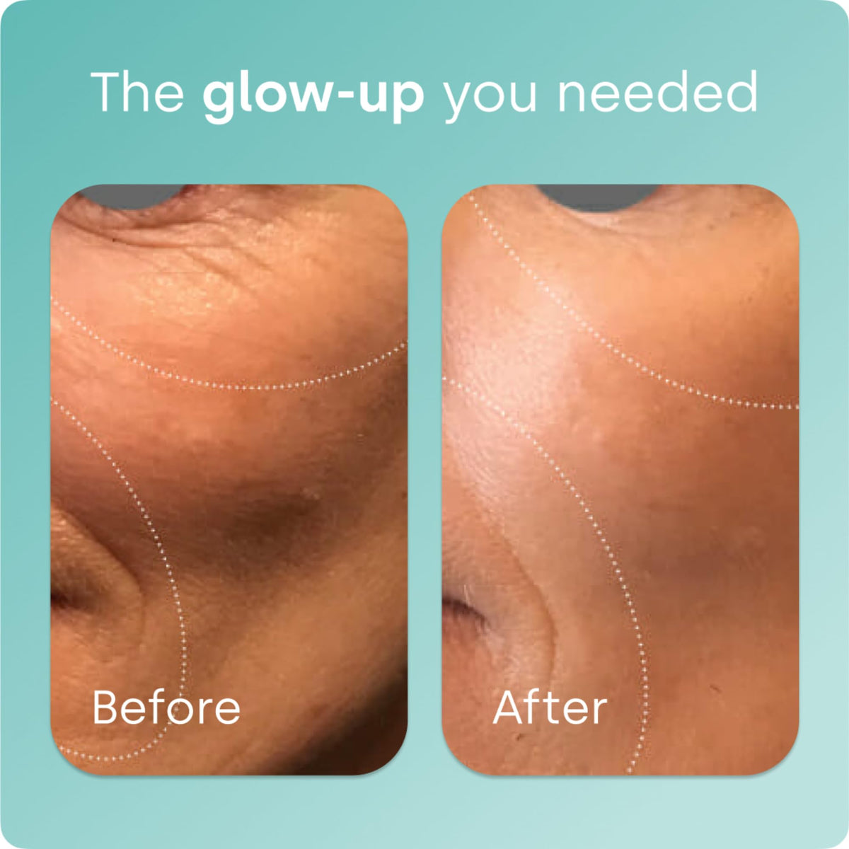 Biosil Collagen Booster Supplement