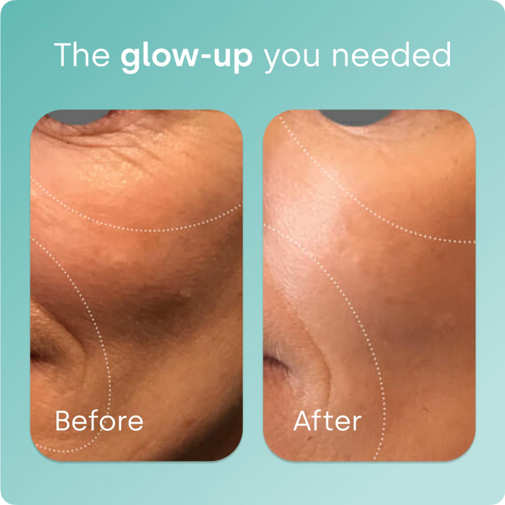 Biosil Collagen Booster Supplement