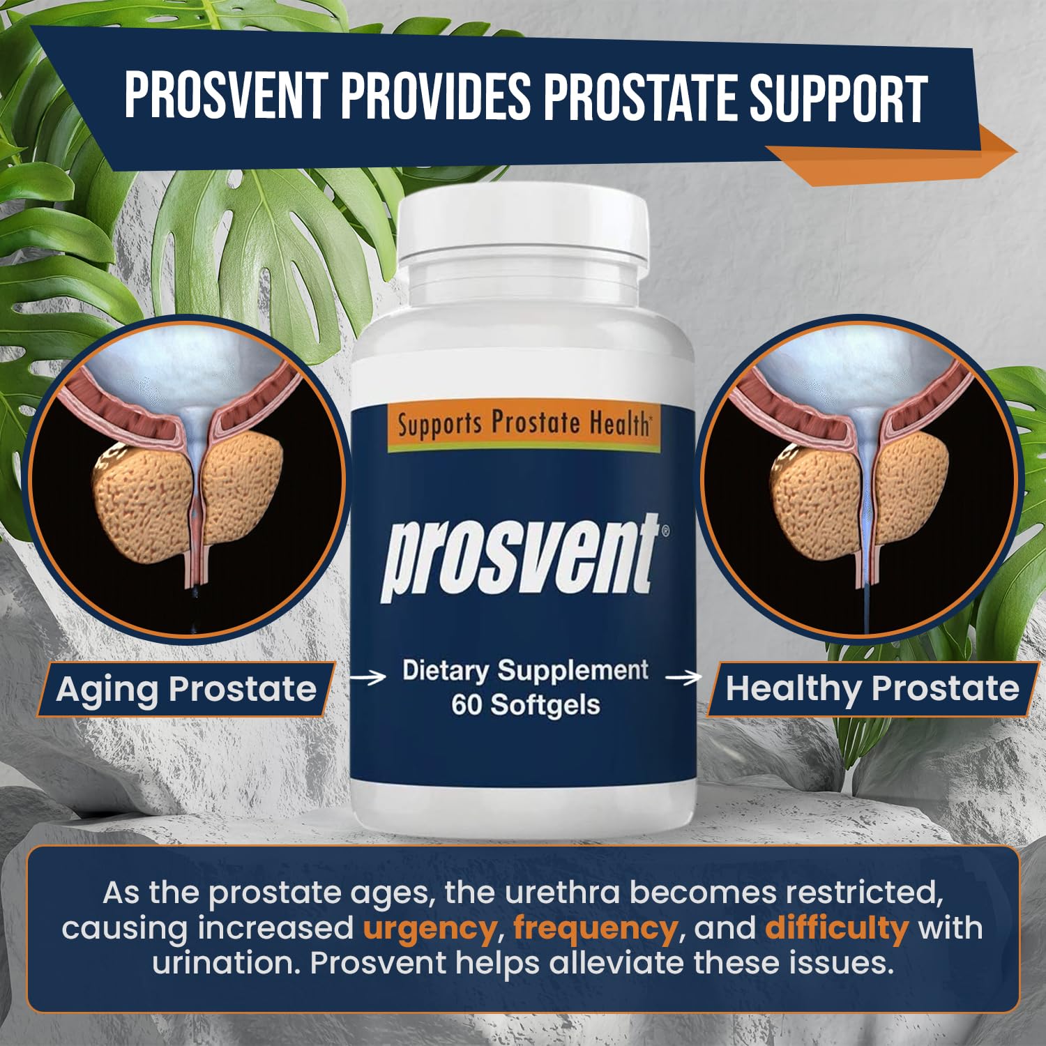 Advanced Men's Prostate Support Natural Supplement with Saw Palmetto, Vitamin D, and Zinc to Ease Urinary Frequency & Urgency (60 Count)