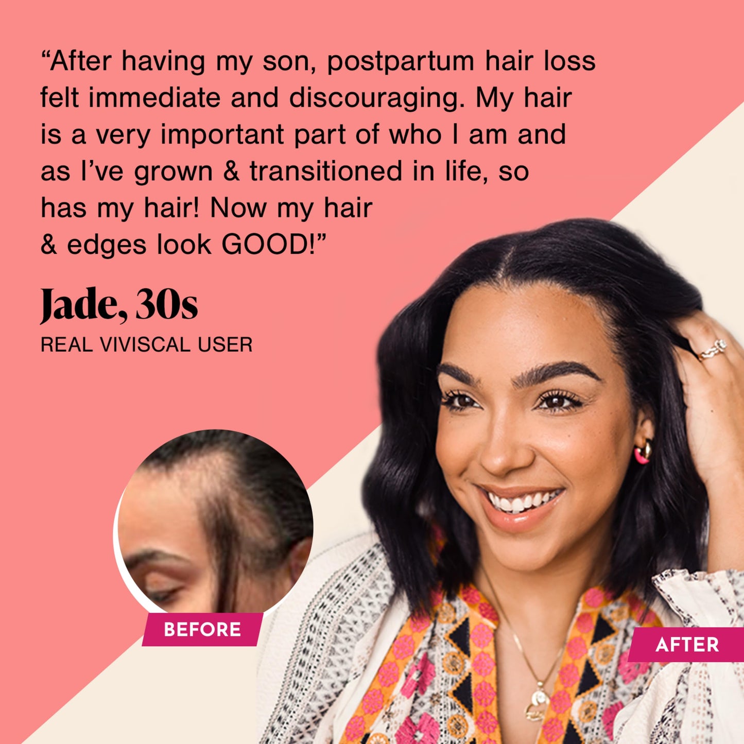 Viviscal Hair Growth Supplements For Women For Thicker, Fuller Hair, Nourishes Thinning & Loss, With Proprietary Collagen Complex, 180 Tablets, 3 Month Supply